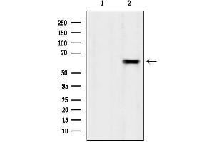 Western blot analysis of lysates from Sp2/0, using TCTN1 Antibody.