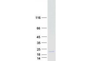 Western Blotting (WB) image for Cytochrome C, Somatic (CYCS) protein (Myc-DYKDDDDK Tag) (ABIN2712812)