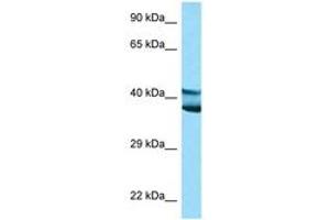 Image no. 1 for anti-Ly1 Antibody Reactive (LYAR) (AA 81-130) antibody (ABIN6748222) (LYAR 抗体  (AA 81-130))