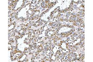 IHC analysis of SUCLG2 using anti-SUCLG2 antibody (ABIN7601694).
