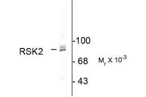 Image no. 1 for anti-Ribosomal Protein S6 Kinase, 90kDa, Polypeptide 3 (RPS6KA3) (C-Term) antibody (ABIN372713)