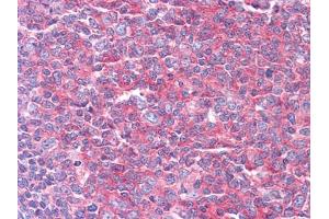 Immunohistochemical analysis of paraffin-embedded human Tonsil tissues using KARS mouse mAb (KARS 抗体)