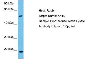 Host:  Mouse  Target Name:  KRT14  Sample Tissue:  Mouse Testis  Antibody Dilution:  1ug/ml (KRT14 抗体  (C-Term))