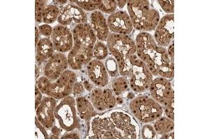 Immunohistochemical staining of human kidney with STRAP polyclonal antibody  shows strong nuclear, cytoplasmic and membranous positivity in cells in tubules at 1:50-1:200 dilution. (STRAP 抗体)