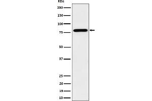 Western blot analysis of PRMT7 expression in HeLa cell lysate. (Recombinant PRMT7 抗体)