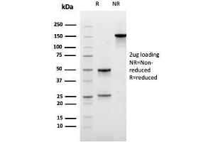 SDS-PAGE (SDS) image for anti-Carboxypeptidase A1 (Pancreatic) (CPA1) antibody (ABIN6939171)