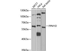 Western blot analysis of extracts of various cell lines, using PPM1D antibody (ABIN6132824, ABIN6146041, ABIN6146042 and ABIN6221792) at 1:1000 dilution. (PPM1D 抗体  (AA 1-250))