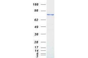 Western Blotting (WB) image for phosphofructokinase, Platelet (PFKP) protein (Myc-DYKDDDDK Tag) (ABIN2728763)