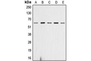 Western blot analysis of AKT (pS473) expression in HeLa (A), SP2/0 (B), mouse heart (C), rat heart (D), rat liver (E) whole cell lysates. (AKT1 抗体  (C-Term, pSer473))