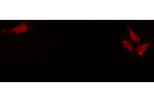 ABIN6272318 staining Hela by IF/ICC. (HEN1/2 抗体)