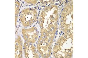 Immunohistochemistry of paraffin-embedded human kidney using RAB5C antibody (ABIN5975504) at dilution of 1/100 (40x lens). (Rab5c 抗体)