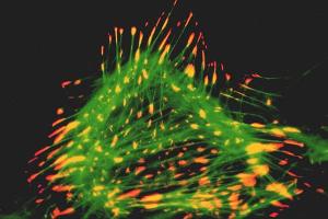 Immunocytochemical staining of a rat cardiac fibroblast using anti-Lipoma Preferred Partner, pAb (IG-817)  (LPP; red fluorescence) and a green-fluorescent phalloidin derivative staining filamentous actin. (LPP 抗体  (AA 1-109))