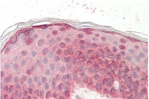 ABIN5539508 (5µg/ml) staining of paraffin embedded Human Skin. (EGF 抗体  (Internal Region))