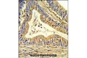 Immunohistochemistry (Paraffin-embedded Sections) (IHC (p)) image for anti-Superoxide Dismutase 1, Soluble (SOD1) (AA 55-84) antibody (ABIN652681)