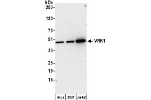 Western Blotting (WB) image for anti-Vaccinia Related Kinase 1 (VRK1) (AA 346-396) antibody (ABIN7450901)