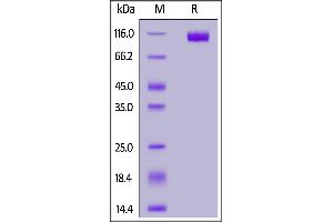 SDS-PAGE (SDS) image for Neural Cell Adhesion Molecule 1 (NCAM1) (AA 20-718) (Active) protein (His tag) (ABIN6992330)