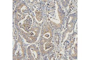 IHC analysis of COPE using anti-COPE antibody (ABIN7602509).