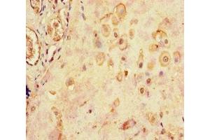 Immunohistochemistry of paraffin-embedded human placenta tissue using ABIN7158587 at dilution of 1:100 (LHB 抗体  (AA 21-141))