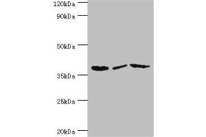 Western blot All lanes: P2RY14 antibody at 12 μg/mL Lane 1: Mouse heart tissue Lane 2: Mouse stomach tissue Lane 3: Mouse small intestine tissue Secondary Goat polyclonal to rabbit IgG at 1/10000 dilution Predicted band size: 39 kDa Observed band size: 39 kDa (P2RY14 抗体  (AA 209-338))