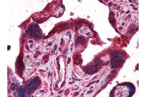 Human Placenta: Formalin-Fixed, Paraffin-Embedded (FFPE) (DPP8 抗体)