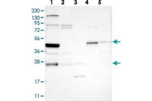 Western blot analysis of Lane 1: RT-4, Lane 2: U-251 MG, Lane 3: Human Plasma, Lane 4: Liver, Lane 5: Tonsil with SMAP2 polyclonal antibody . (SMAP2 抗体)