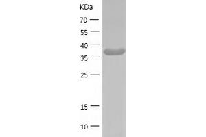 GMDS Protein (AA 1-372) (His tag)