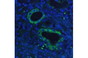 IF analysis of Hexokinase 1/HK1 using anti-Hexokinase 1/HK1 antibody (ABIN7600259).
