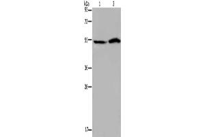 Gel: 8 % SDS-PAGE, Lysate: 40 μg, Lane 1-2: Hela cells, 293T cells, Primary antibody: ABIN7192423(SLC22A12 Antibody) at dilution 1/200, Secondary antibody: Goat anti rabbit IgG at 1/8000 dilution, Exposure time: 40 seconds (SLC22A12 抗体)