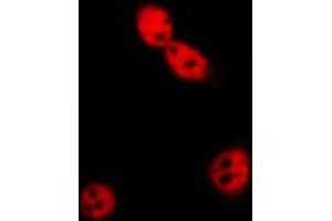 ABIN6269196 staining MCF7 by IF/ICC. (Cyclin E1 抗体  (C-Term))