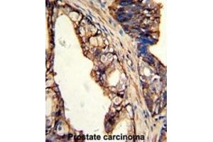 Immunohistochemistry (IHC) image for anti-Transglutaminase 4 (Prostate) (TGM4) antibody (ABIN3002879) (TGM4 抗体)