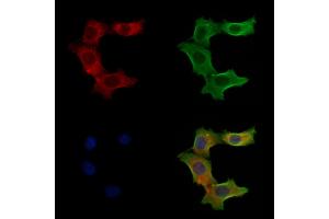 ABIN6257487 and ABIN6275419 staining Hela cells by IF/ICC. (S100A3 抗体  (Internal Region))