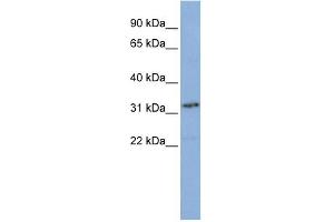 WB Suggested Anti-SNAPC2 Antibody Titration: 0. (SNAPC2 抗体  (N-Term))