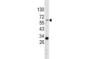 Western blot analysis of Tyrosinase Antibody (C-term) Cat.