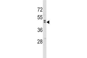 Western blot analysis of WNT10B antibody and MDA-MB231 lysate.