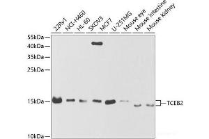 Western Blotting (WB) image for anti-Transcription Elongation Factor B (SIII), Polypeptide 2 (18kDa, Elongin B) (TCEB2) antibody (ABIN7010591)