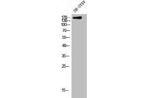 Western Blot analysis of SH-SY5Y cells using CLASP1 Polyclonal Antibody (CLASP1 抗体  (C-Term))
