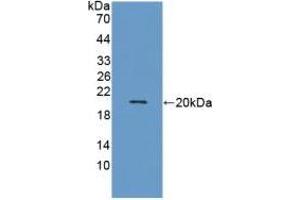 Western Blotting (WB) image for anti-Matrix Metallopeptidase 9 (Gelatinase B, 92kDa Gelatinase, 92kDa Type IV Collagenase) (MMP9) (AA 213-399) antibody (ABIN7425935)