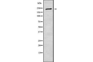 Western blot analysis of CROCC using COLO205 whole cell lysates (CROCC 抗体  (N-Term))