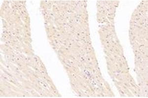 Immunohistochemistry analysis of paraffin-embedded rat heart using,CA5A (ABIN7073309) at dilution of 1: 3000 (CA5A 抗体)