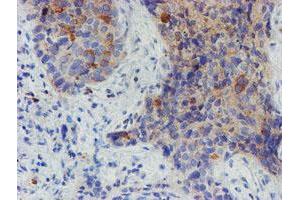 Image no. 1 for anti-Myoneurin (MYNN) (AA 10-300) antibody (ABIN1490790) (Myoneurin 抗体  (AA 10-300))