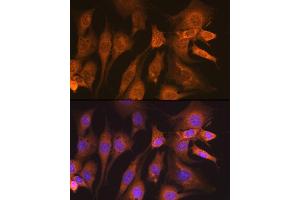 Immunofluorescence analysis of NIH-3T3 cells using Guanylyl Cyclase beta 1 (GUCY1B3) (GUCY1B3) Rabbit mAb (ABIN7267551) at dilution of 1:100 (40x lens). (GUCY1B3 抗体)