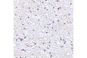Immunohistochemistry of TSLP in human brain tissue with this product at 2. (Thymic Stromal Lymphopoietin 抗体  (Center))