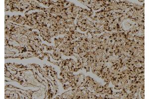ABIN6274039 at 1/100 staining Human lung tissue by IHC-P. (PPP1CA + 1CB 抗体)