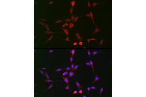 Immunofluorescence analysis of BALB-3T3 cells using LOX Rabbit pAb (ABIN6133805, ABIN6143288, ABIN6143289 and ABIN6223629) at dilution of 1:100 (40x lens). (LOX 抗体)