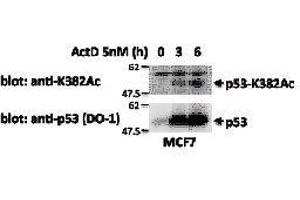 Western Blotting (WB) image for anti-Tumor Protein P53 (TP53) (acLys382) antibody (ABIN3201008) (p53 抗体  (acLys382))