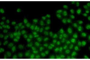 Immunofluorescence analysis of HeLa cells using ID3 Polyclonal Antibody (ID3 抗体)