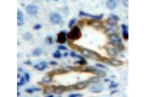 IHC-P analysis of Liver tissue, with DAB staining. (CEACAM1 抗体  (AA 35-143))