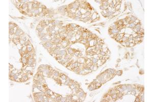 Immunohistochemistry (IHC) image for anti-Lysyl-tRNA Synthetase (KARS) (C-Term) antibody (ABIN7448981) (KARS 抗体  (C-Term))