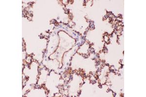 Immunohistochemistry (IHC) image for anti-Angiotensin I Converting Enzyme (Peptidyl-Dipeptidase A) 1 (ACE) (AA 651-864) antibody (ABIN3043777)