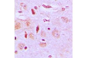 Immunohistochemical analysis of NEURL2 staining in human brain formalin fixed paraffin embedded tissue section. (NEURL2 抗体  (Center))